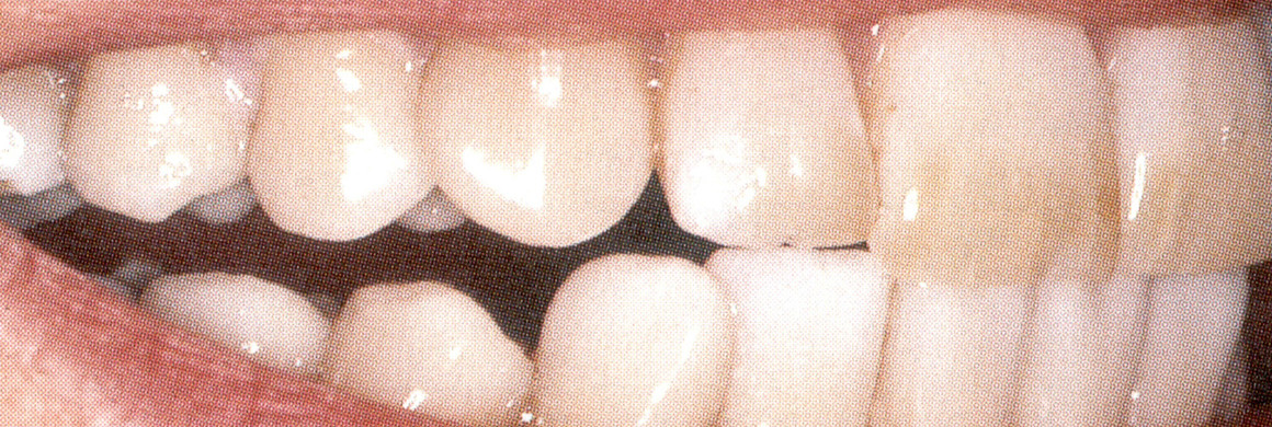 MacchieDentali