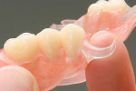 ProtesiDental